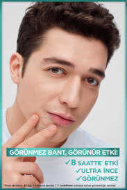 Garnier Cilt Kusurları Karşıtı Sivilce Bandı 22’li